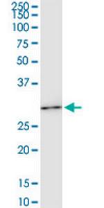 HOXC6 Monoclonal Antibody (2A4)