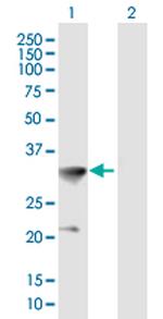 HOXC8 Polyclonal Antibody, MaxPab™