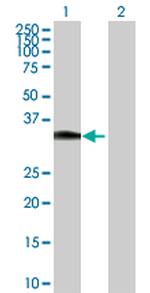 HOXC8 Antibody in Western Blot (WB)