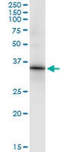 HOXC8 Monoclonal Antibody (1H2)