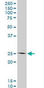 HOXC12 Antibody in Western Blot (WB)