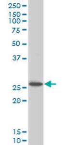 HOXC12 Antibody in Western Blot (WB)