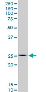 HOXC12 Monoclonal Antibody (1C6)