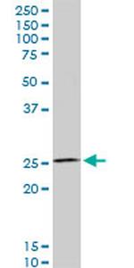 HOXC12 Antibody in Western Blot (WB)