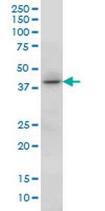 HOXC13 Monoclonal Antibody (10D4)