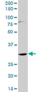 HOXD1 Antibody in Western Blot (WB)