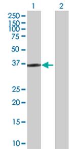 HOXD1 Polyclonal Antibody, MaxPab™