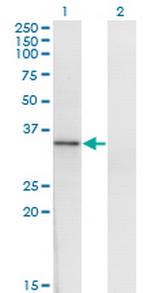 HOXD1 Monoclonal Antibody (4F4)