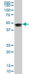 HOXD3 Antibody in Western Blot (WB)