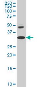HOXD8 Monoclonal Antibody (5E11)