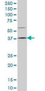 HOXD9 Monoclonal Antibody (2A9)