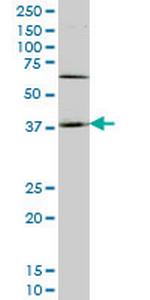 HOXD11 Monoclonal Antibody (5E7)