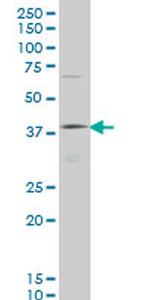 HOXD11 Antibody in Western Blot (WB)