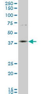 HOXD11 Monoclonal Antibody (6D8)