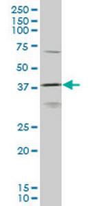 HOXD11 Monoclonal Antibody (6C8)