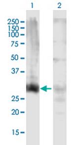 HOXD13 Polyclonal Antibody, MaxPab™