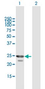 HPGD Polyclonal Antibody, MaxPab™