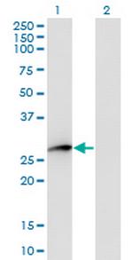 HPGD Monoclonal Antibody (1D8)