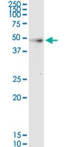HPN Monoclonal Antibody (2D5)