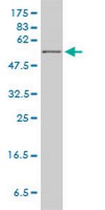 HPRT1 Monoclonal Antibody (4C3-G8)