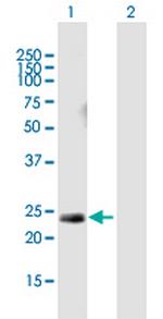 HRAS Antibody in Western Blot (WB)