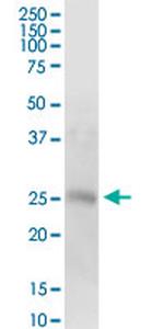 HRAS Antibody in Western Blot (WB)