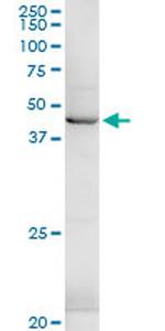 HSD3B1 Antibody in Western Blot (WB)