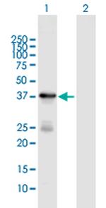 HSD3B1 Polyclonal Antibody, MaxPab™