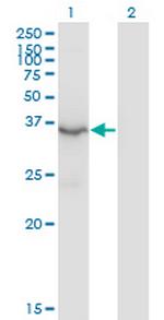 HSD3B2 Monoclonal Antibody (1E8)
