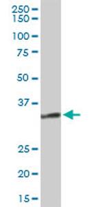 HSD11B1 Antibody in Western Blot (WB)