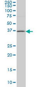 HSD17B1 Monoclonal Antibody (2E5)