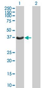 HSD17B2 Polyclonal Antibody, MaxPab™