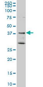 DNAJB2 Monoclonal Antibody (1B7)