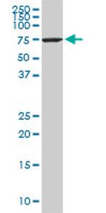 HSPA1L Monoclonal Antibody (1B5)