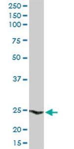 HSPB1 Antibody in Western Blot (WB)
