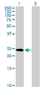 HSPB1 Antibody in Western Blot (WB)