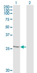 HSPB1 Monoclonal Antibody (3G3)