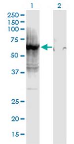 HSPD1 Monoclonal Antibody (2A7)