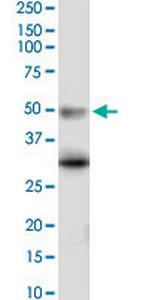 HTR5A Monoclonal Antibody (3D1)