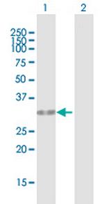 HUS1 Polyclonal Antibody, MaxPab™