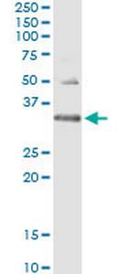 HUS1 Monoclonal Antibody (2B12)