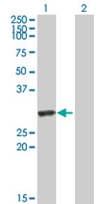 HYAL1 Polyclonal Antibody, MaxPab™