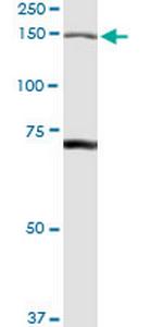 IARS Polyclonal Antibody, MaxPab™