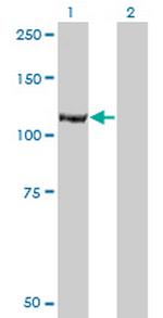 IARS Monoclonal Antibody (3D3)