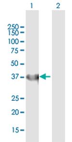 IDH3A Antibody in Western Blot (WB)