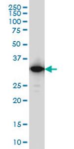 IFI35 Monoclonal Antibody (3H6)
