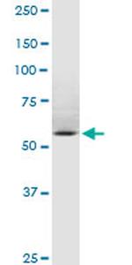 SP110 Antibody in Western Blot (WB)