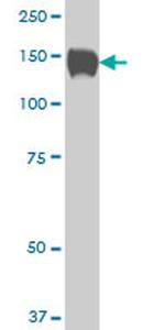 SP110 Antibody in Western Blot (WB)