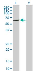 IFIT1 Polyclonal Antibody, MaxPab™