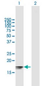 IFNA2 Antibody in Western Blot (WB)